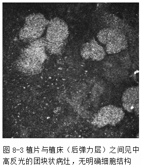 ZY016_34_3.gif
